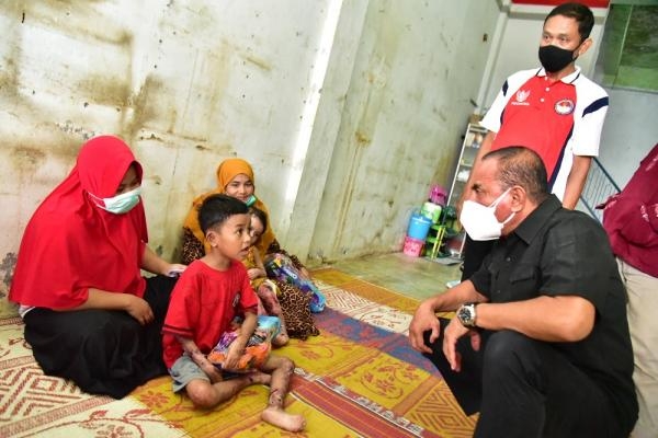 Jenguk Dua Anak Penderita Penyakit Kulit, Edy Rahmayadi Rujuk Haikal dan Zakira ke RS Haji Medan
